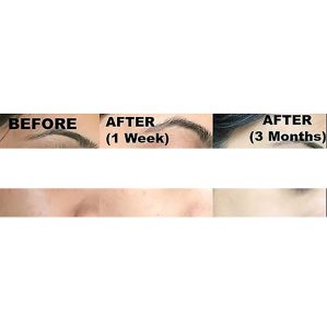 Kojie San Skin Lightening Classic Soap135g - Image 4